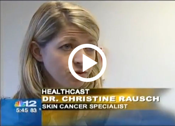 Dr. Christine Rausch discusses Mohs Surgery on Channel 12 News Richmond, VA